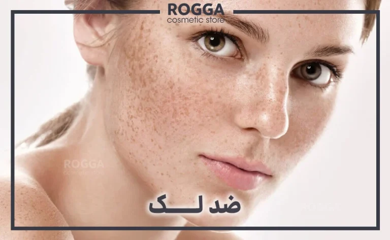 رایج ترین دلایل ایجاد لک صورت چیست؟