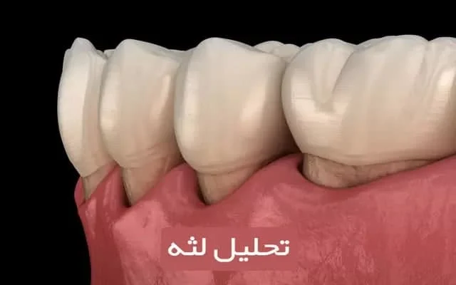 درمان