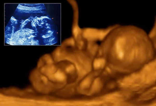Dangers of the seventh month of pregnancy