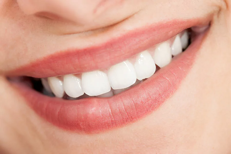 Does teeth whitening harm it