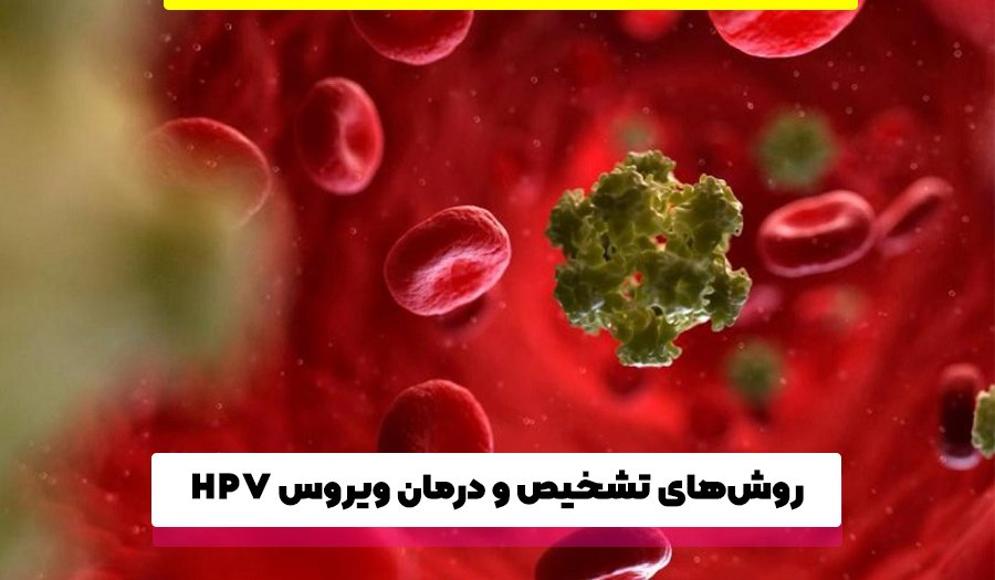  روش‌های تشخیص و درمان ویروس HPV 