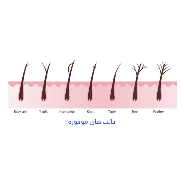 درمان انواع موخوره